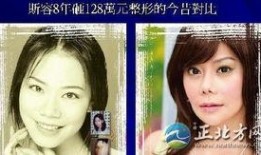 福州整形爆料事件视频最新,揭露行业黑幕，真相令人震惊